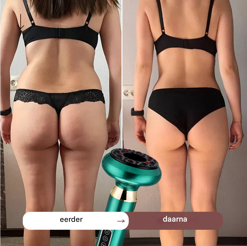CelluSculpt™ | Ervaar zichtbaar gladdere en stevigere huid